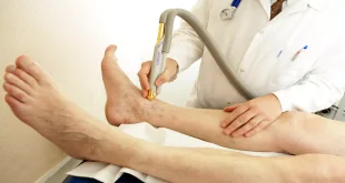 How Is Radiofrequency And Laser Varicose Vein Treatment Performed?