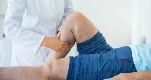 What Is the Best Treatment Method for Varicose Veins?